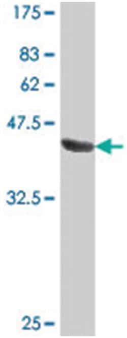 PMPCB, Mouse, Polyclonal Antibody, Abnova 50&mu;L; Unlabeled:Antibodies,