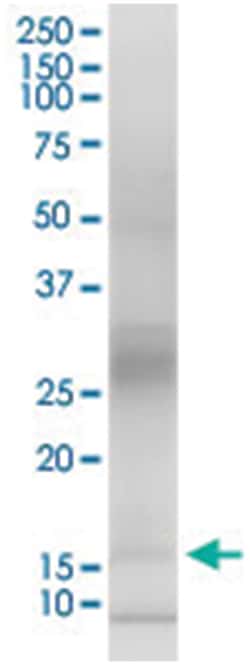 PTGES, Human, IP-WB Antibody Pair (PW3), Abnova 1 Set | Buy Online | Abnova Corporation | Fisher Scientific