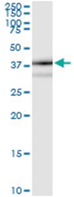 anti-TP53I3, Human, IP-WB Antibody Pair, Abnova™
