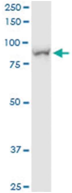 anti-H6PD, Human, IP-WB Antibody Pair, Abnova&trade;