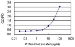 anti-BCAR1 Matched Antibody Pair, Abnova™