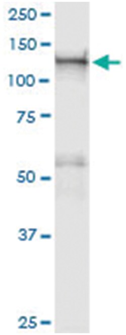 anti-GTF2IRD1, Human, IP-WB Antibody Pair, Abnova&trade;