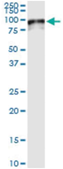 anti-SOX13, Human, IP-WB Antibody Pair, Abnova&trade;