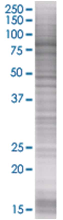 SOX13 293T Cell Overexpression Lysate (Denatured), Abnova 100 &mu;L | Buy Online | Abnova | Fisher Scientific