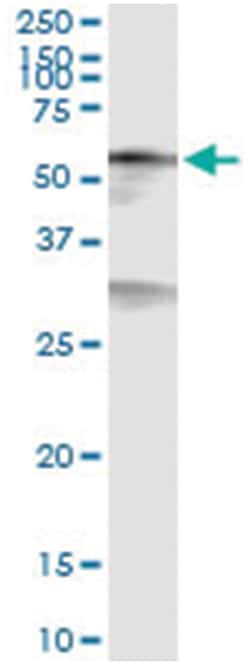 anti-CREB5, Human, IP-WB Antibody Pair, Abnova 1 Set:Antibodies, Monoclonal/Polyclonal