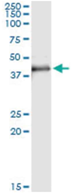 MAD2L1BP, Human, IP-WB Antibody Pair (PW2), Abnova&trade;