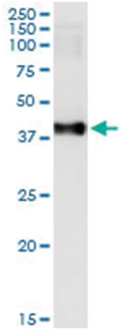MAD2L1BP, Human, IP-WB Antibody Pair (PW3), Abnova&trade;