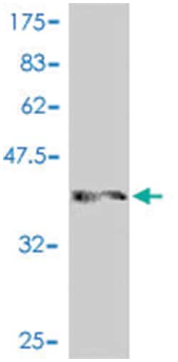NCOR1, Mouse, Polyclonal Antibody, Abnova 50&mu;L; Unlabeled:Antibodies,