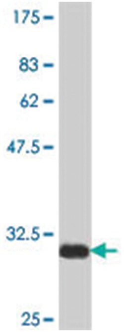 nuclear receptor co-repressor 2, Mouse, Polyclonal Antibody, Abnova 50&mu;L;