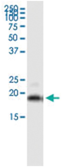 GUCA1C, Human, IP-WB Antibody Pair (PW3), Abnova&trade;