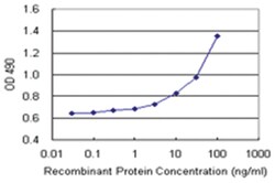 anti-FEZ1 Matched Antibody Pair, Abnova 1 Set, Unlabeled:Antibodies, Monoclonal/Polyclonal