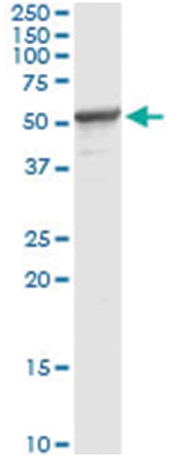 PPM1F, Human, IP-WB Antibody Pair (PW2), Abnova™