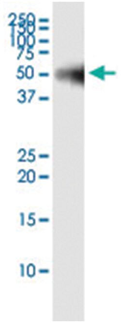 PPM1F, Human, IP-WB Antibody Pair (PW3), Abnova 1 Set:Antibodies, Monoclonal/Polyclonal