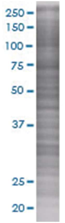SOCS5 293T Cell Overexpression Lysate (Denatured), Abnova 100 &mu;L | Buy Online | Abnova | Fisher Scientific