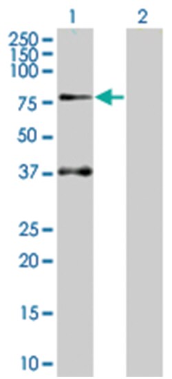SOCS5 293T Cell Overexpression Lysate (Denatured), Abnova 100 &mu;L | Buy Online | Abnova | Fisher Scientific