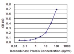 anti-PDE4DIP, Human, Matched Antibody Pair, Abnova&trade;