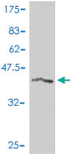 RAPGEF2, Mouse, Polyclonal Antibody, Abnova 50&mu;L; Unlabeled:Antibodies,