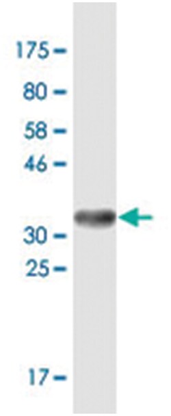 ULK2, Mouse, Clone: X1, Abnova 200 &mu;L | Buy Online | Abnova | Fisher Scientific