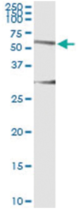HERPUD1, Human, IP-WB Antibody Pair (PW2), Abnova&trade;