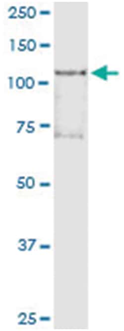 anti-HDAC4, Human, IP-WB Antibody Pair, Abnova&trade;
