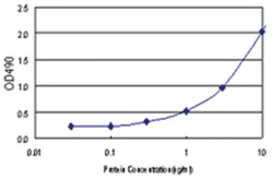 anti-ZFYVE16 Matched Antibody Pair, Abnova™