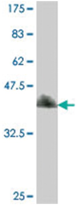 DDX48, Mouse, Polyclonal Antibody, Abnova 50&mu;L; Unlabeled:Antibodies,