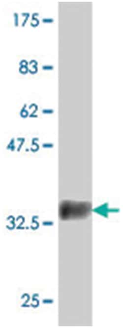 IHPK1, Mouse, Polyclonal Antibody, Abnova 50 &mu;L | Buy Online | Abnova Corporation | Fisher Scientific