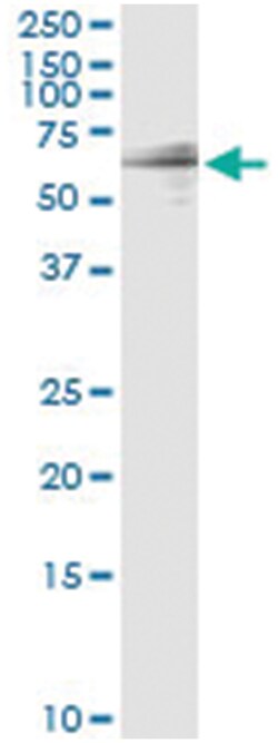 anti-GIT2, Human, IP-WB Antibody Pair, Abnova&trade;