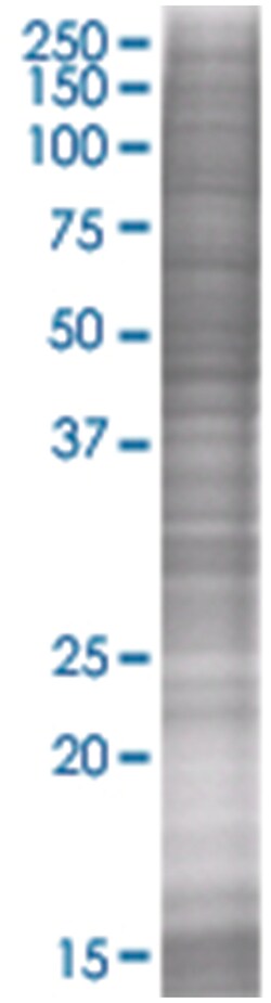 GIT2 293T Cell Overexpression Lysate (Denatured), Abnova 100 &mu;L | Buy Online | Abnova | Fisher Scientific
