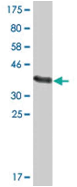 TSC22 domain family, member 2, Mouse, Clone: 6G10, Abnova 200 &mu;L | Buy Online | Abnova Corporation | Fisher Scientific
