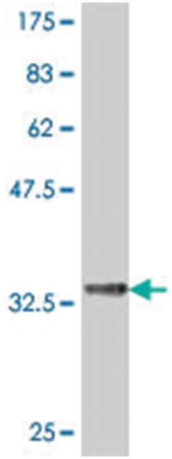 armadillo repeat containing, X-linked 2 (A01), Mouse anti-Human, Polyclonal