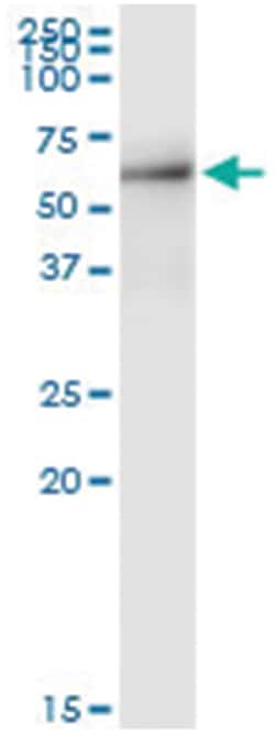anti-SPATA2, Human, IP-WB Antibody Pair, Abnova&trade;