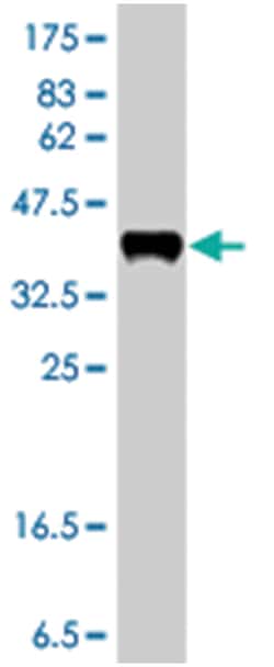 MAGI2, Mouse, Polyclonal Antibody, Abnova™