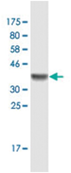 SETDB1, Mouse, Clone: 4E8, Abnova 200&mu;L; Unlabeled:Antibodies, Monoclonal