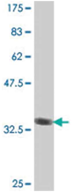 NCAPD2 (CNAP1), Mouse, Polyclonal Antibody, Abnova 50&mu;L; Unlabeled:Antibodies,