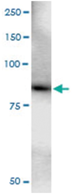 anti-KIAA0020, Human, IP-WB Antibody Pair, Abnova™