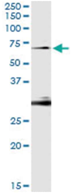 OXSR1, Human, IP-WB Antibody Pair (PW1), Abnova&trade;