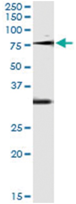 OXSR1, Human, IP-WB Antibody Pair (PW4), Abnova&trade;