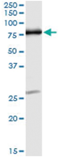 OXSR1, Human, IP-WB Antibody Pair (PW5), Abnova™