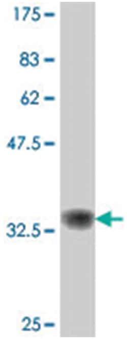 USP3, Mouse, Polyclonal Antibody, Abnova 50&mu;L; Unlabeled:Antibodies,