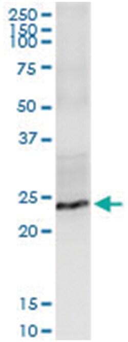 anti-FGF19, Human, IP-WB Antibody Pair, Abnova™