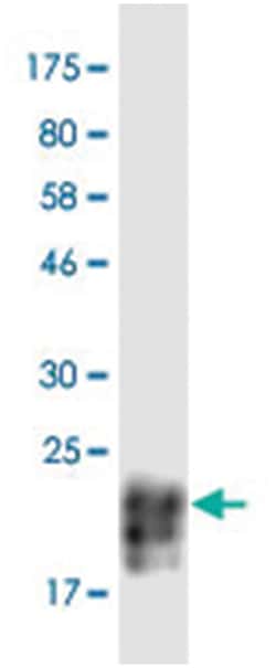 anti-TNFSF15, Clone: 3H1, Abnova 100&mu;g, Unlabeled:Antibodies, Monoclonal
