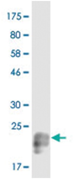 anti-TNFSF15, Clone: 3B1, Abnova 100 &mu;g | Buy Online | Abnova Corporation | Fisher Scientific