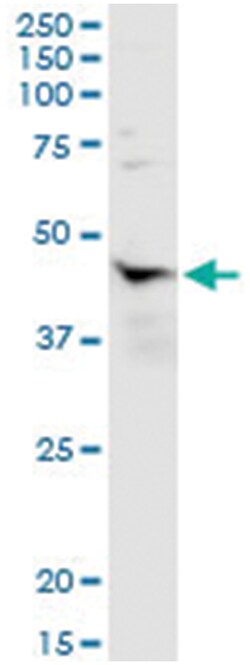 anti-NR1I3, Human, IP-WB Antibody Pair, Abnova™