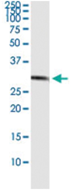 CCS, Human, IP-WB Antibody Pair (PW3), Abnova&trade;