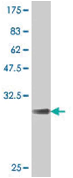 KCNE2, Mouse, Polyclonal Antibody, Abnova 50&mu;L; Unlabeled:Antibodies,