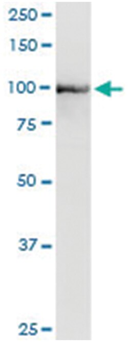 anti-PDCD6IP, Human, IP-WB Antibody Pair, Abnova 1 Set:Antibodies, Monoclonal/Polyclonal