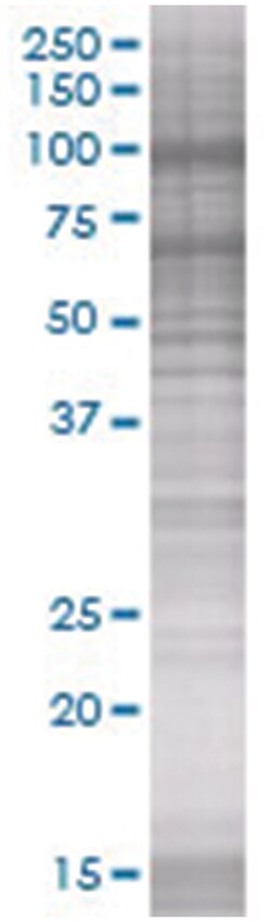 PDCD6IP 293T Cell Overexpression Lysate 2 (Denatured), Abnova 100 &mu;L | Buy Online | Abnova | Fisher Scientific
