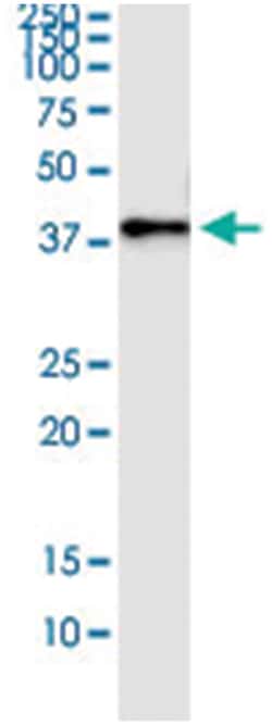 DNAJB6, Human, IP-WB Antibody Pair (PW4), Abnova&trade;