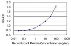 anti-SAE1 Matched Antibody Pair, Ab-1, Abnova